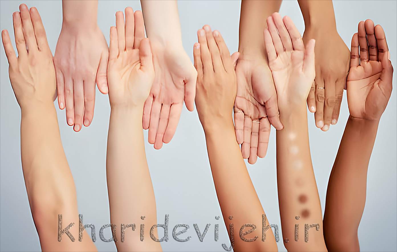 ته رنگ پوست چیست؟